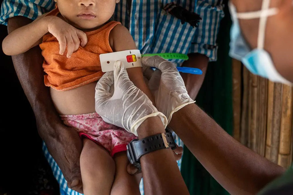 A baby is screened for acute malnutrition by a community healthcare worker in the Rohingya refugee camp in Cox's Bazar, Bangladesh. Malnutrition is one of the key issues faced by tens of thousands of Rohingya families living in Bangladesh.