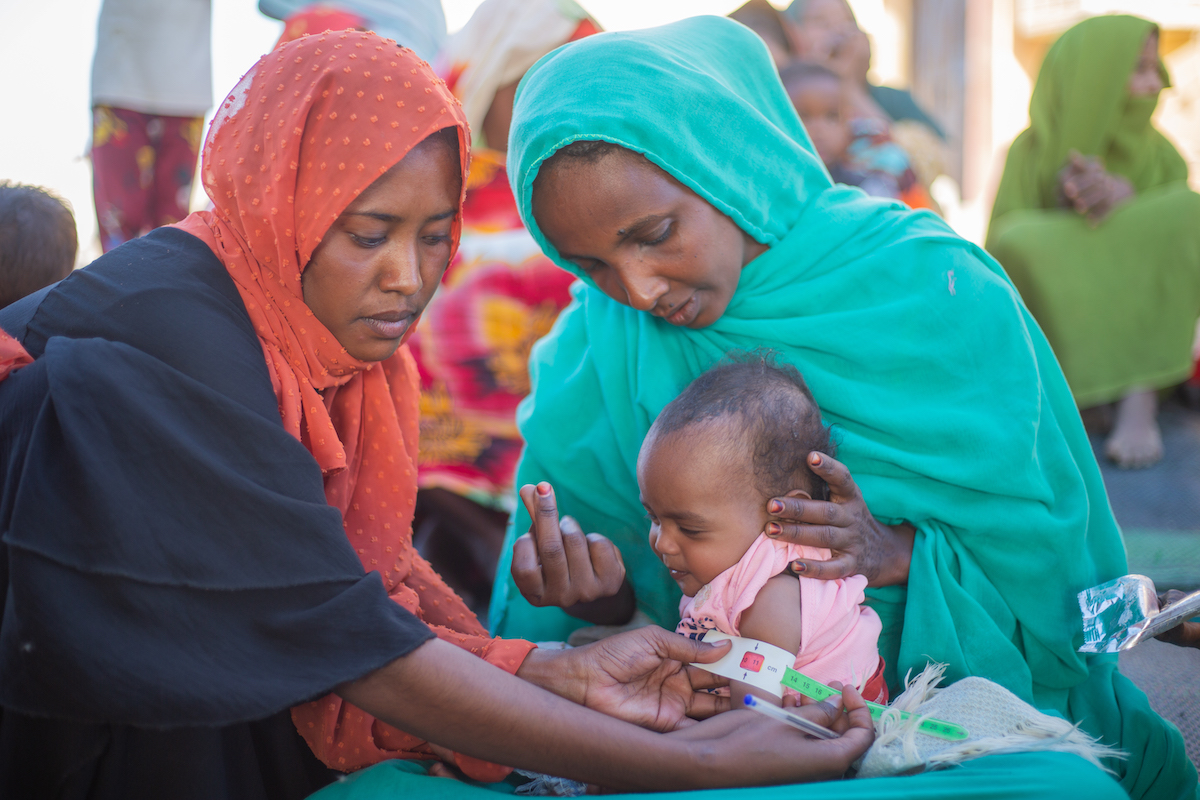 Two-year-old Aida is screened for malnutrition during the mass mid-upper arm circumference (MUAC) screening and referral for children under five in River Nile State. Aida is severely malnourished, very weak and requires immediate treatment. (Photo: Ahmed Elfatih Mohamdeen/UNICEF)