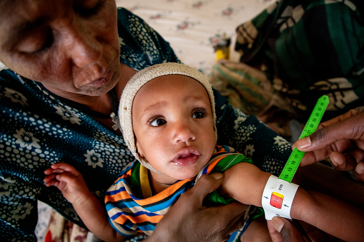 Azalu Tamu holds one of her twin girls as her mid-upper-arm circumference (MUAC) is measured in Amhara, Ethiopia. (Photo: Eugene Ikua/Concern Worldwide)