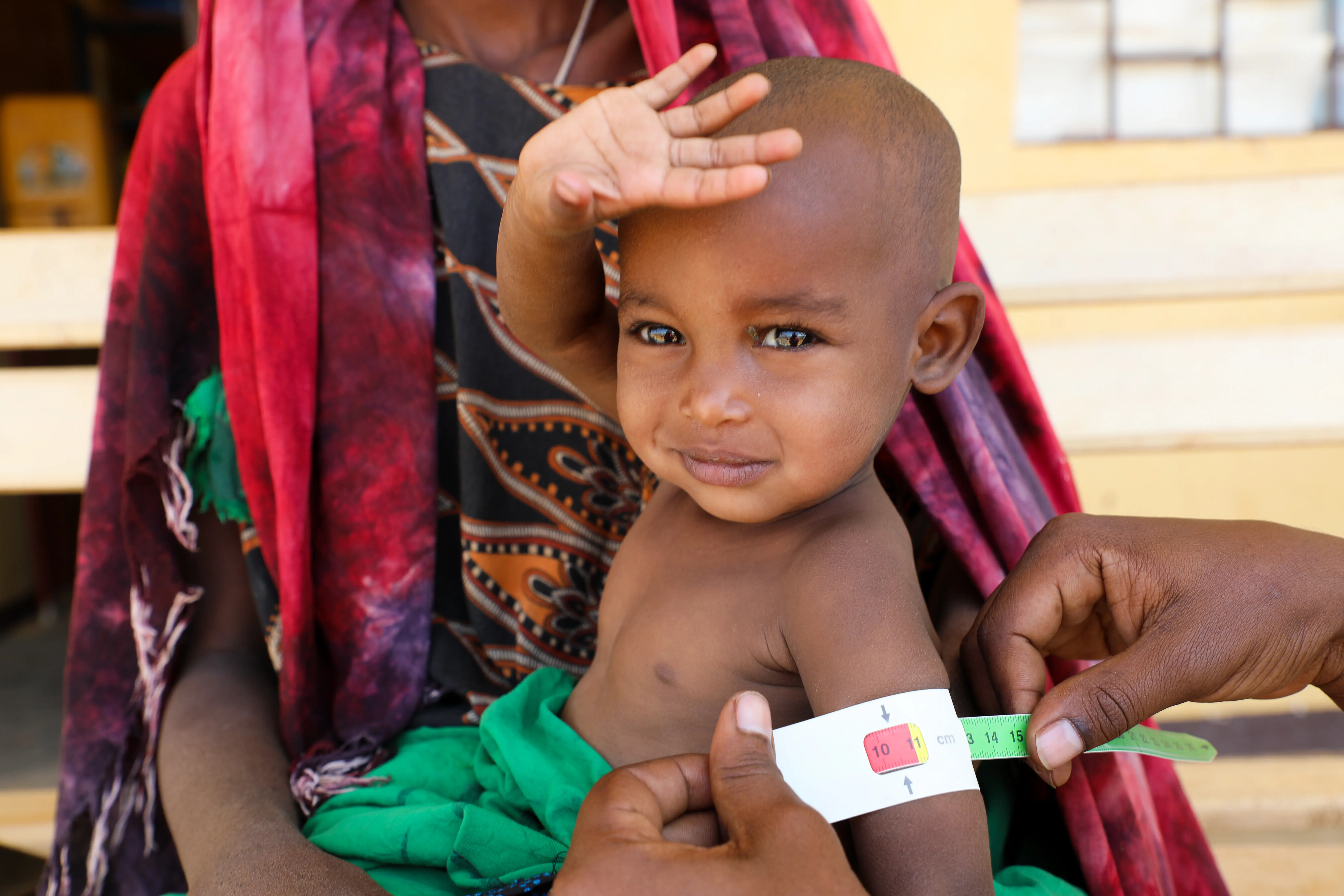 An infant receives treatment for severe acute malnutrition in a remote health centre in Ethiopia